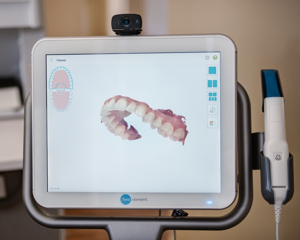 Itero Technology, Kamloops Dentist